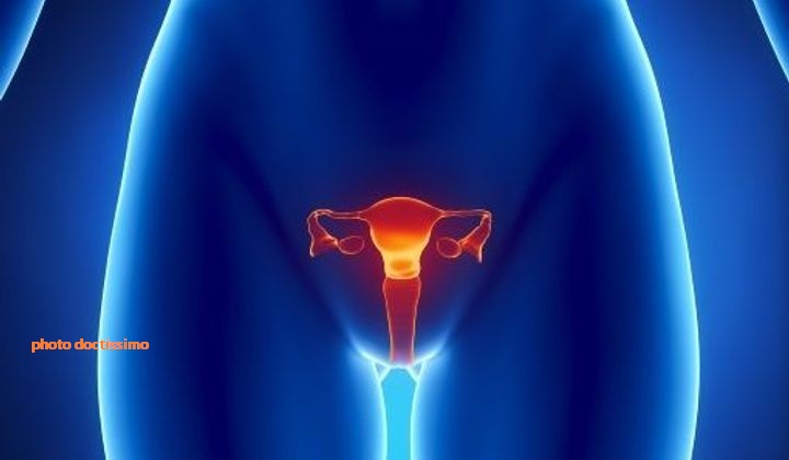 Sud kivu : Le cancer du col de l'utérus tue des femmes faute d ...