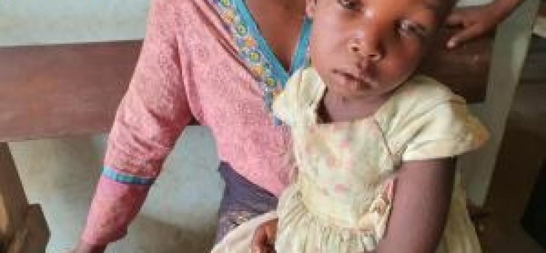 Sud-Kivu : 185 cas de décès enregistrés suite à la rougeole depuis le début de l’année 2022